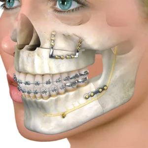 The Long Road to Relief: Why Patients Travel for Advanced Jaw and TMJ Care