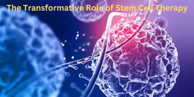 The transformative role of stem cell therapy